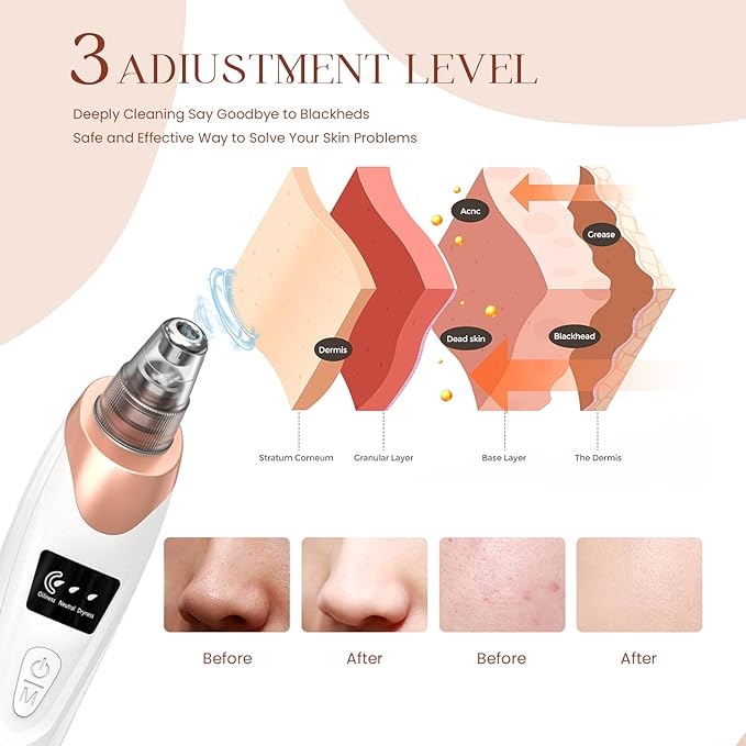 Unclog pores without irritation