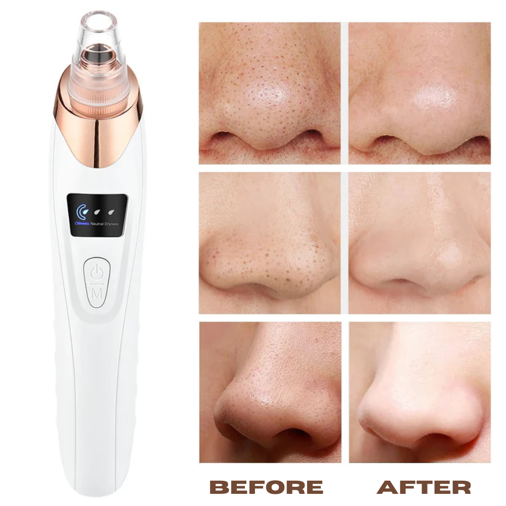 Unclog pores without irritation