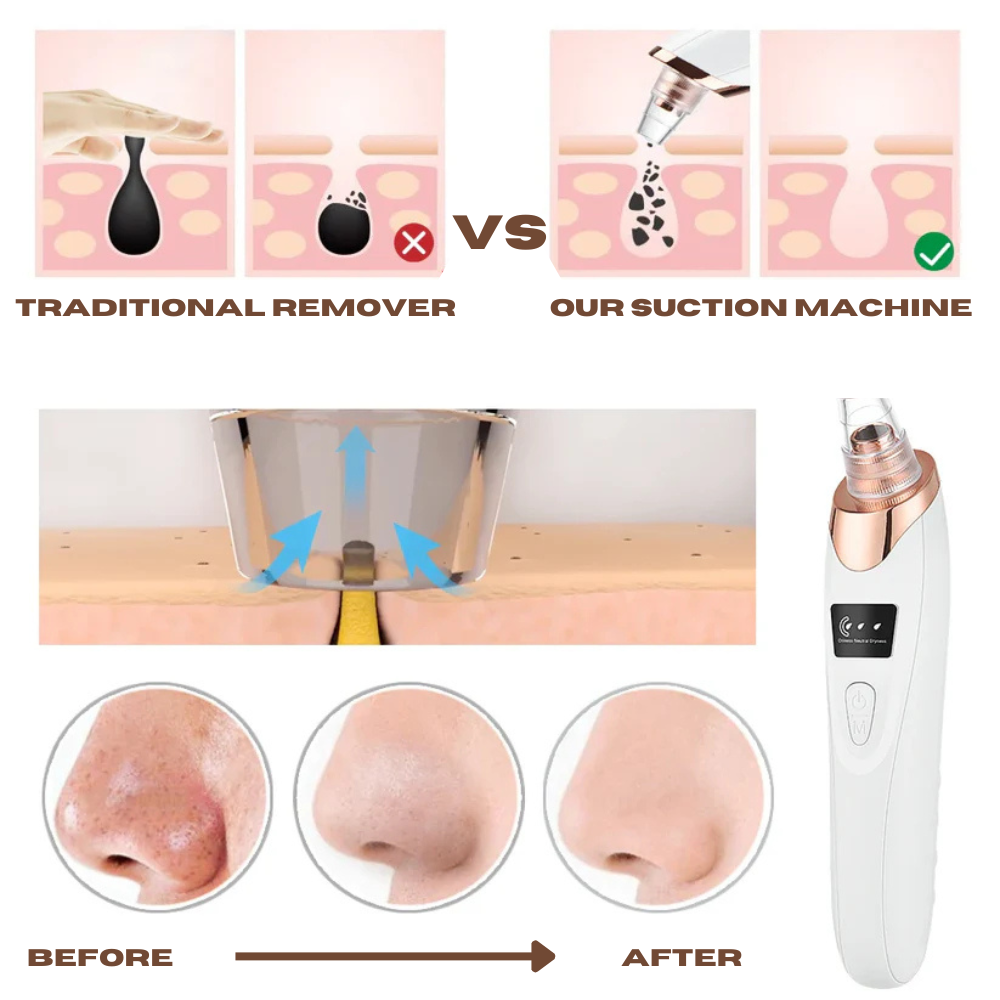 Unclog pores without irritation
