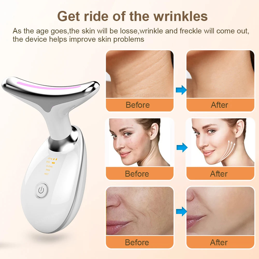 3 Colour LED FACE Beauty Massager